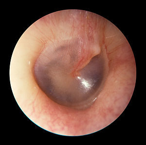 normal eardrum